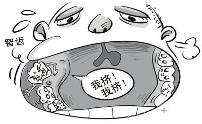 成都牙齿矫正需要拔智齿吗