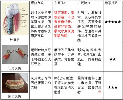 牙齿缺失修复攻略—方法篇2