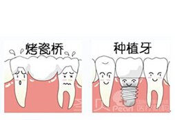 牙齿断裂美容冠修复3