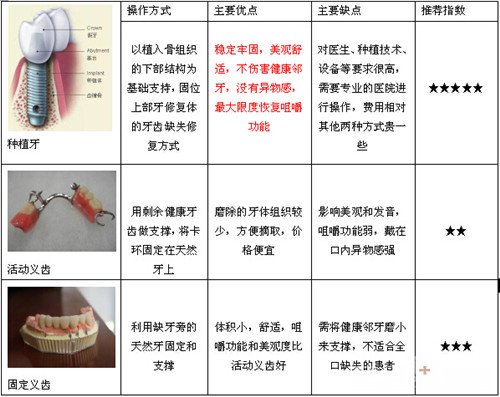 缺牙后为什么一定要镶牙2