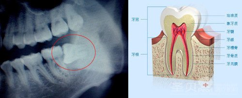 拔牙前需要做什么检查2