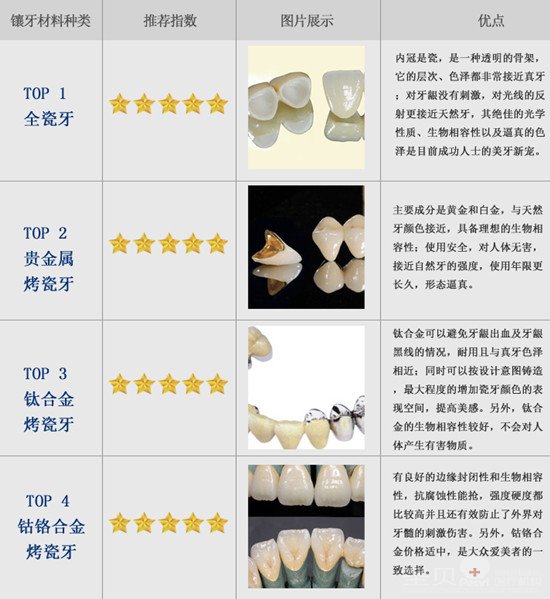 牙科揭秘：镶牙材料哪种好