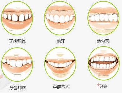 牙齿矫正作用大  让你美丽亮出来