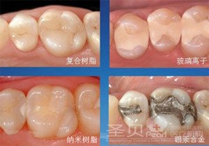 补牙全攻略——技术篇2