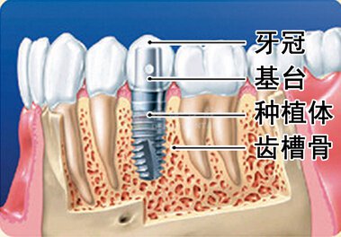 成都看牙科哪家医院好